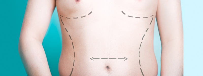 Liposuction Image | Arizona Advanced Surgery
